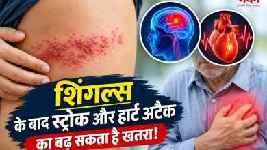 Photo of शरीर के एक तरफ जलन और फफोले? हो सकता है शिंगल्स, जानिए क्यों है यह खतरनाक